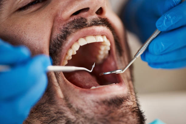 Best Dental X-Rays and Imaging  in Hallsville, TX